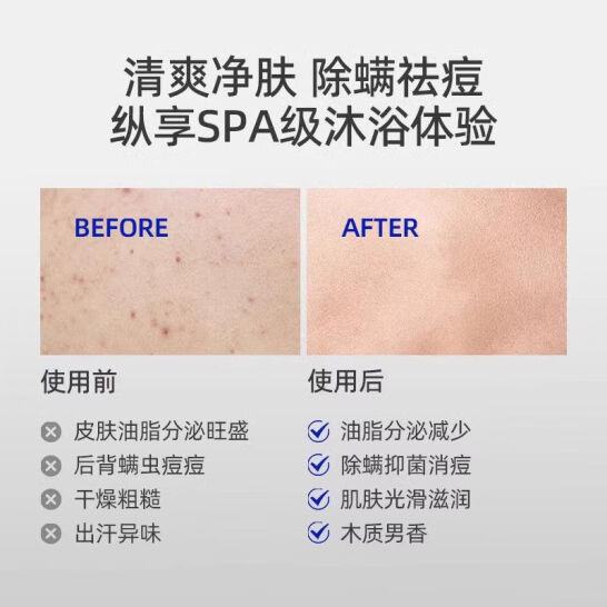 除螨沐浴露